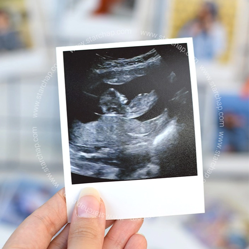 چاپ عکس پلوراید